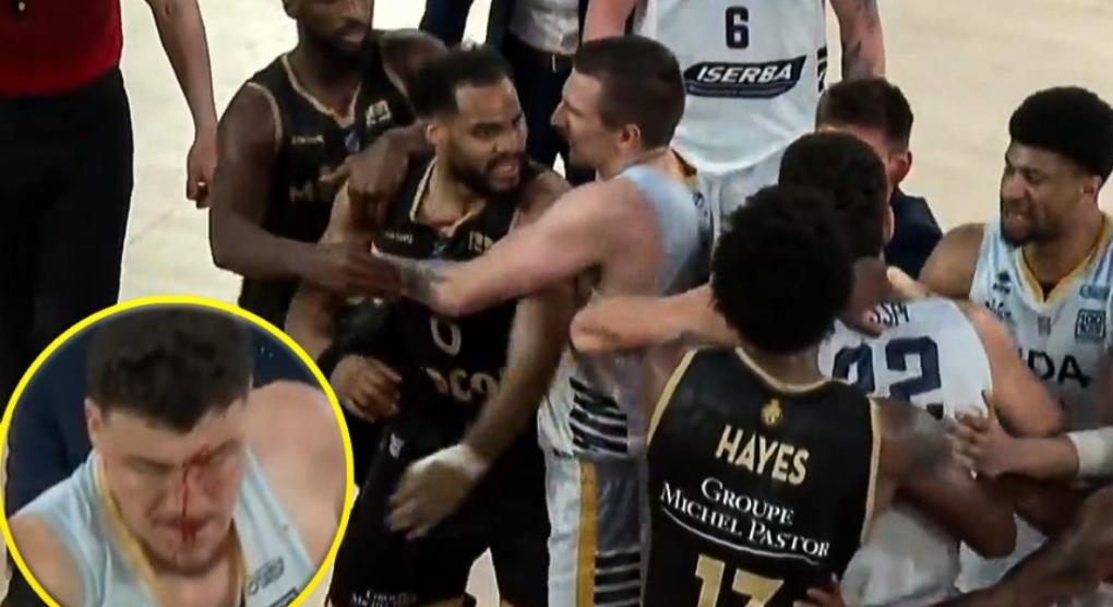 Χαμός στο Μονακό-Ντιζόν: Σύρραξη στο γήπεδο, μάτωσε ο Λοσέρ