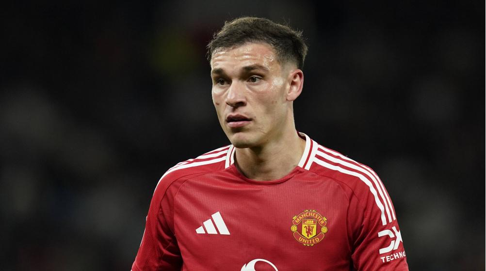 Η Νιούκαστλ δίνει την λύση στην Γιουνάιτεντ για τον Ουγκάρτε